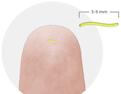 Sourcetoday Com Sites Sourcetoday com Files Uploads 2016 04 Profusa Thumb Sourcetoday Com Sites Sourcetoday com Files Uploads 2016 04 Profusa Thumb