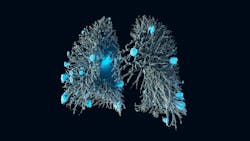 Fraun_Lung_Prom Fraun_Lung_Prom