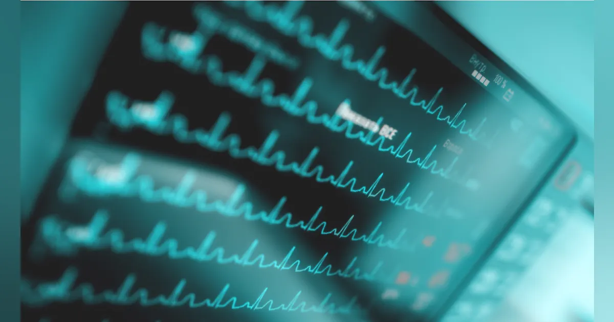 VitalConnect’s Cardiac Monitoring “VitalPatch” Receives Emergency FDA ...